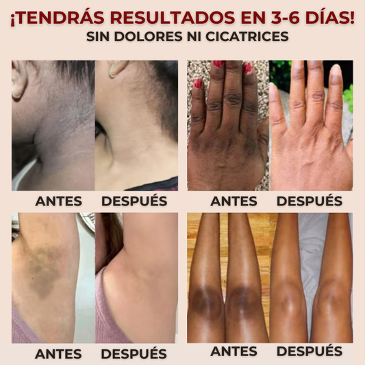 Gel Exfoliante Aclarador