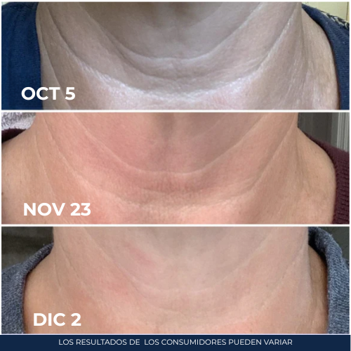 CREMA LIFTING REAFIRMANTE PARA EL CUELLO
