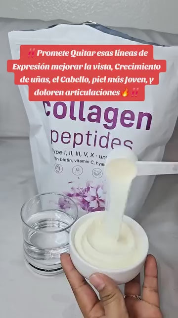 Cargar video: 